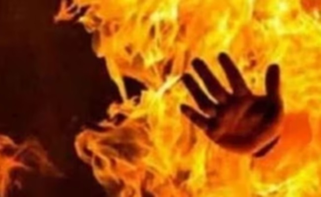Toilet Commode Exploded: Youth Suffered 35% Burns
