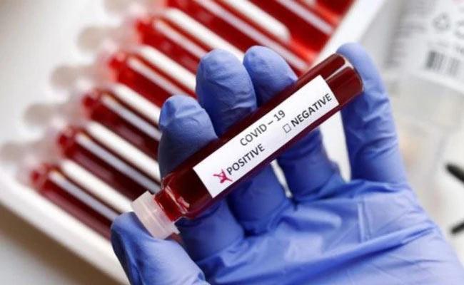 Hyd firm, Australian varsity to develop Covid-19 vaccine
